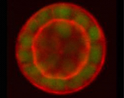 Epithelial Cyst Formation in 3-D Life Hydrogels