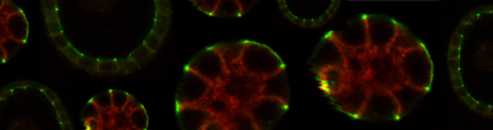 Epithelial cyst formation in 3d cell culture and immunostaining of junctions