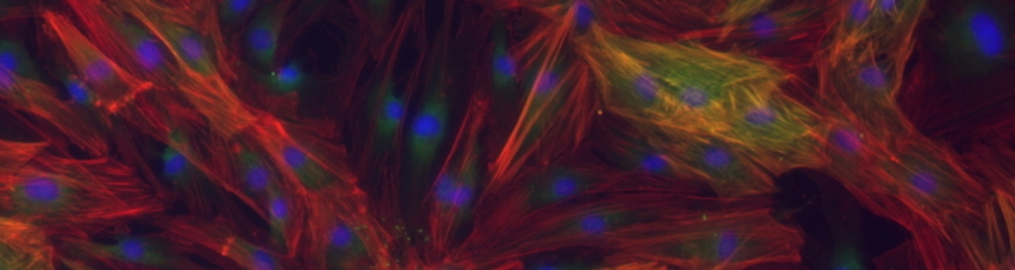 Image of cytoskeleton of cells