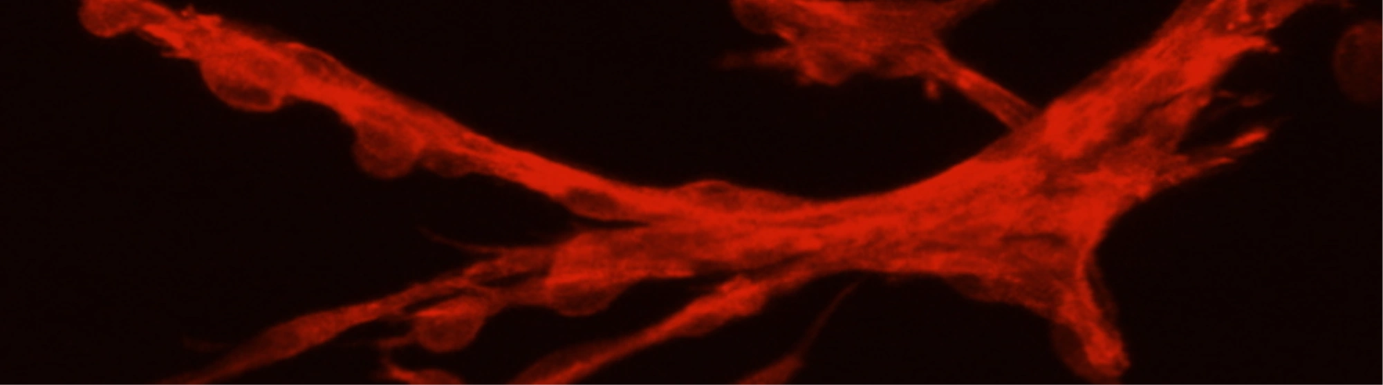 Image of fibroblasts in 3D cell culture